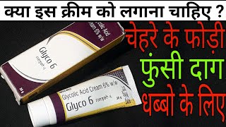 Glyco 6 Cream Review Hindi [upl. by Hermine]