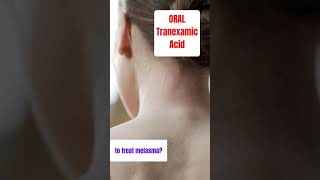 tranexamic acid ORAL for melasma treatment shorts [upl. by Desdee]