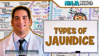 Gastrointestinal  Types of Jaundice [upl. by Atiloj]