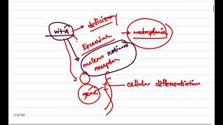 General Pathology Class 7 Mechanism of Metaplasia Dr Murtoza Shahriar [upl. by Iene331]