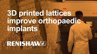 3D printed lattices improve orthopaedic implants [upl. by Edny]