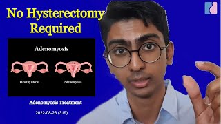 Adenomyosis Treatment No Hysterectomy Needed  Antai Hospitals [upl. by Ynogoham542]