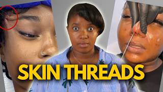 The Dangers Of SKIN THREADING and IMPLANTS [upl. by Chancelor]