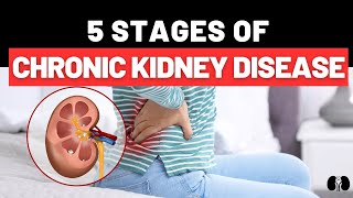 5 Stages of Chronic Kidney Disease [upl. by Meares]