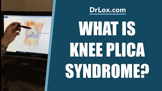 What is Knee Plica Syndrome  Do You Need Plica Surgery  Dr Lox Explains [upl. by Neroled905]