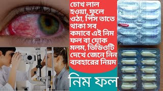 Nimphol or chloramphenicol eye ointment use for to reduce any common eye infection [upl. by Nnaitak]