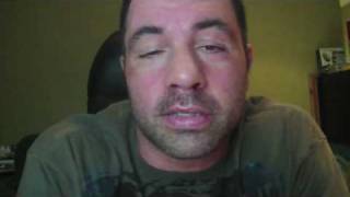 Joe Rogan deviated septum operation [upl. by Natassia736]