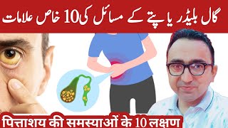 The 12 Signs that Your Gallbladder is in Danger  Dr Javaid [upl. by Ludly]