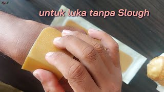 DuoDerm Extra Thin Apakah Bisa Untuk Luka Ca mamae  RaFer QnA [upl. by Ritch]