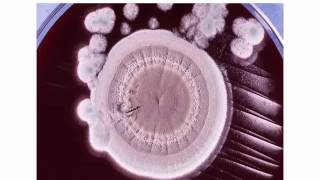 Identification of Filamentous Fungi Hyaline Monomorphic Fungi Part 4 Hot topic [upl. by Benedicto]