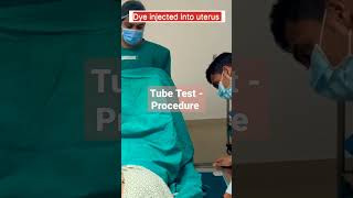 HSG Test  How its done infertility hsgtest viralshorts shorts tubetest [upl. by Jerz785]