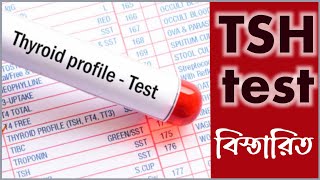 Tsh test report bangla  থাইরয়েড হরমোন টেস্ট খরচ কতো [upl. by Ling927]