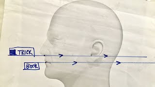 How To Take An Odontoid View XRay  Perfectly  Every Time [upl. by Samanthia]