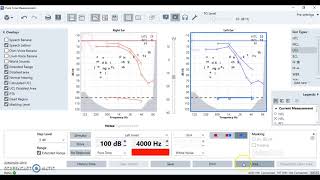 Understanding a Hearing Test [upl. by Cybil826]