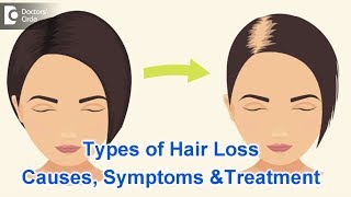 Types of Hair Loss  Common Causes Symptoms amp Treatment  Dr Kavitha GV Mandal [upl. by Hobbie]