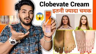 Clobevate Cream Review  Clobevate Cream For Skin Whitening [upl. by Lorraine]