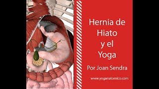 HERNIA DE HIATO Y EL YOGA [upl. by Ward]