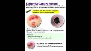 Ecthyma gangrenosum [upl. by Maximo]