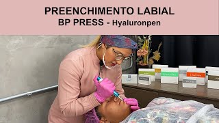 PREENCHIMENTO LABIAL  Hyaluron Pen  BP PRESS [upl. by Nossyla]