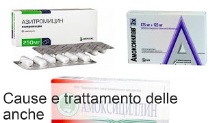 Gonfiore allanca cause sintomi e trattamento [upl. by Pickar]