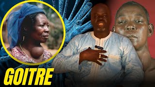 Goitre 1   Causes et Conséquences   Pr Ousmane Ndiaye  SAMA XALAAT TV [upl. by Bellina]