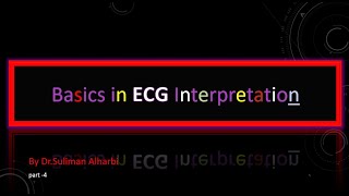 Basics in ECG Interpretation part 4 slide shows [upl. by Laumas]