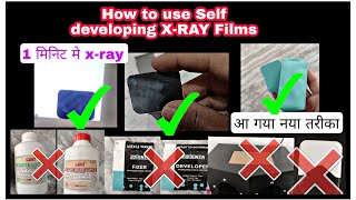 How to use Self developing XRAY Films hemadental dental dentalcare dentalhygienist dentistry [upl. by Anina]