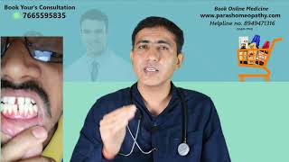 Leukoplakia Homeopathy Treatment  लयूकोप्लाकिया  White Patches In Mouth  Leukoplakia Medicine [upl. by Thebazile739]