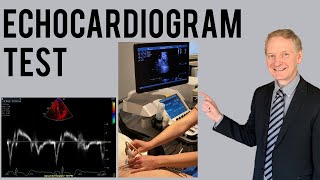 Echocardiogram Procedure  Heart Ultrasound  Everything you need to know [upl. by Ajaj]