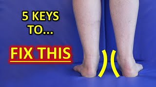 The 5 KEYS To Improve Flat Feet Fallen Arches amp Foot Overpronation [upl. by Assenar604]