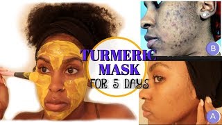 I Used a TURMERIC MASK for 1 Week and THIS HAPPENED  How to Fade Dark Spots [upl. by Shepp]