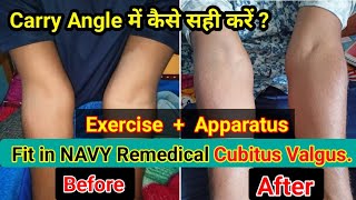 Carry Angle कैसे सही करें How my brother Fit in Navy Remedical  Exercise  Apparatus  Best Tips [upl. by Mukund]