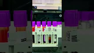 CBC Blood Test Complete Blood Count by Sysmex XN1000™ [upl. by Ellehciram19]