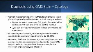 Development of a PCR Diagnostic test for Detection of Pneumocystis jirovecii [upl. by Laing515]