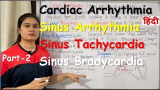 Cardiac Arrhythmia  Part2  Sinus Arrhythmia  Sinus Tachycardia  Sinus Bradycardia  Treatment [upl. by Nomahs]