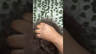 Fast amp Aggressive Scalp Scratching ASMR asmr asmrsounds scalpscratch shorts viral foryou fyp [upl. by Kassandra]