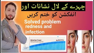 How to solved problem face redness skin Infection problem solved advantan cream [upl. by Hgielyk443]