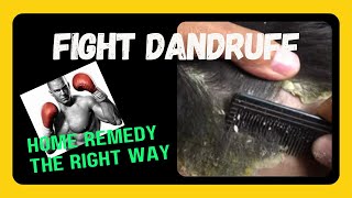 Best Home Remedies To Remove Dandruff [upl. by Willtrude]