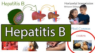 Hepatitis B symptoms treatment and prevention [upl. by Frederik]