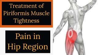 Treatment of Piriformis Muscle Tightness  Hip joint Pain Relief Exercises [upl. by Ambert]