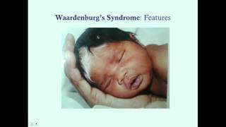 Waardenburgs Syndrome  CRASH Medical Review Series [upl. by Austina63]