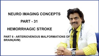 NEUROIMAGING CONCEPTS PART31PART 6HEMORRHAGIC STROKE ARTERIOVENOUS MALFORMATION OFTHE BRAINAVM [upl. by Ydna397]