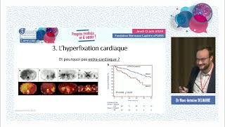 La scintigraphie osseuse dans l’amylose à transthyrétine  intérêt et limites [upl. by Land]