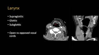 Neck CT search pattern [upl. by Hailee166]