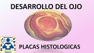 Embriologia Desarrollo de ojo Placas histologicas [upl. by Shaun849]