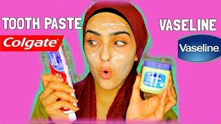 I APPLIED TOOTHPASTE AND VASELINE ON MY FACE  Look What Happened   Immy [upl. by Obmar859]