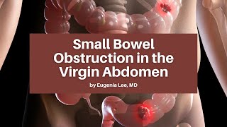 Small Bowel Obstruction in the Virgin Abdomen  The USC Trauma amp Surgery Course [upl. by Adahs]