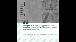 Dr Zhan Zimbakov on Dynetic®35 and the benefits of iliac stenting from a transradial approach [upl. by Anile]