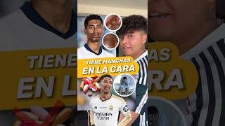 😱 ¿Que le ha pasado a Jude Bellingham Mira el video y entérate‼️ futbol shorts football soccer [upl. by Ajtak]