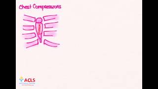 NRP Chest Compressions amp Ventilations by ACLS Certification Institute [upl. by Shuma]